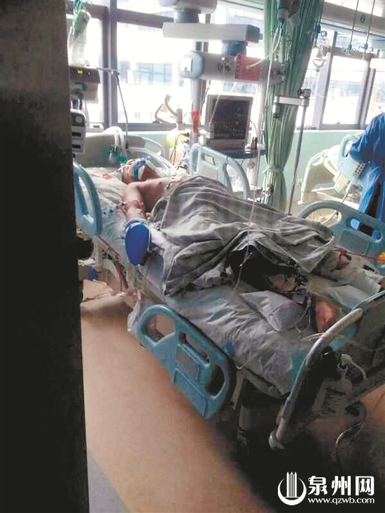 苏建蓉仍在重症监护室接受急救 