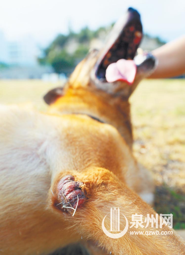 长期的训练使得梅西的脚关节上长出了厚厚的痂